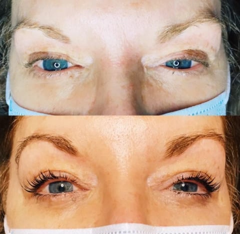 Before and after comparison of eyelash enhancement showing sparse lashes above and fuller, darker lashes below