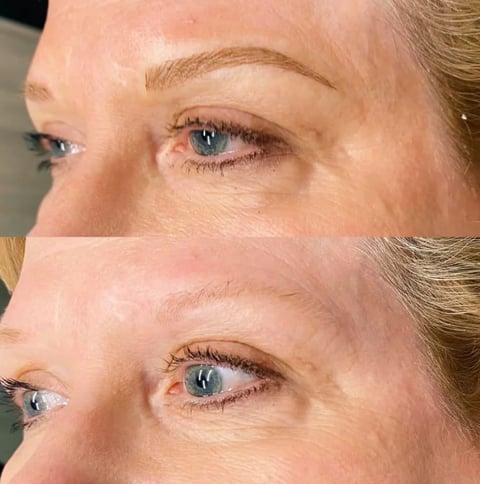 Before and after comparison of eye area showing eyelash enhancement treatment results on a middle-aged woman